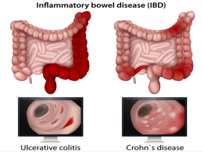 Gastrointestinal Issues - kulkarnisclinic.com