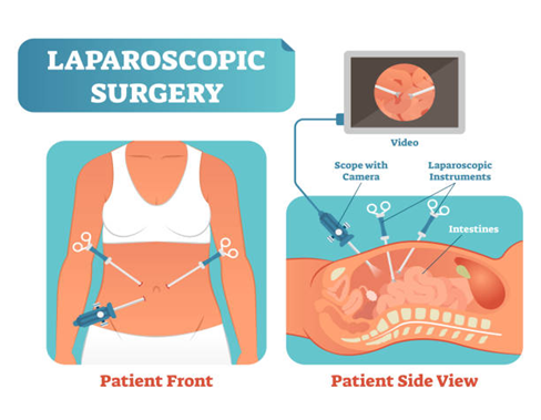 Endoscopic and Minimally Invasive Surgery