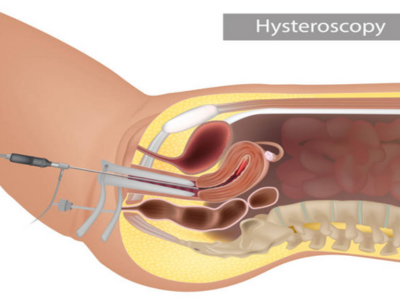 Further Testing - kulkarnisclinic.com