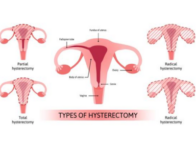 Surgical Options - kulkarnisclinic.com