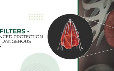 Understanding IVC Filters: A Crucial Tool in Blood Clot Prevention