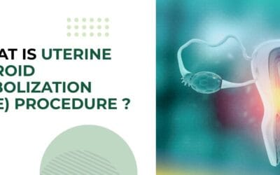 What Is Uterine Fibroid Embolization (UFE) Procedure?