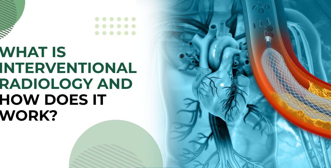What Is Interventional Radiology and How Does It Work?