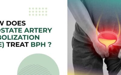 How Does Prostate Artery Embolization (PAE) Treat BPH?