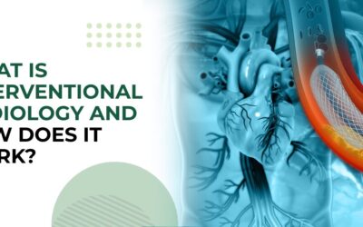 What Is Interventional Radiology and How Does It Work?